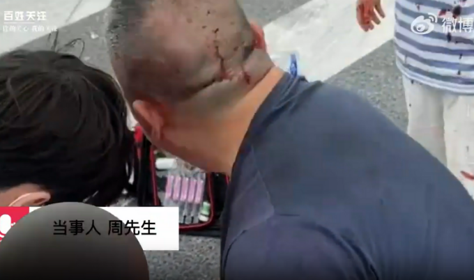 儿子被撞送医途中车祸致女儿身亡 网友：祸不单行-多多发布网(图1)